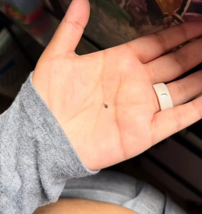 Painless Skin Tag Removal Kit